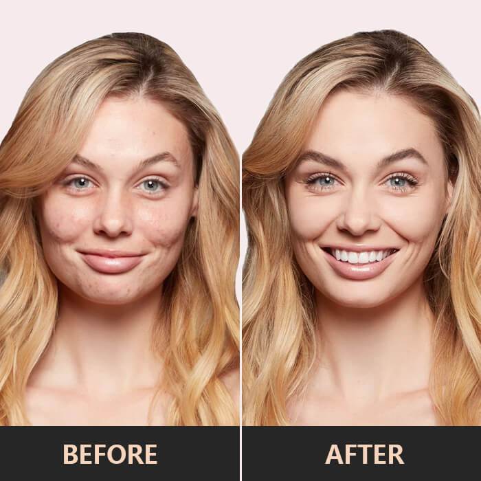 Farbkorrektur Concealer Palette für Frauen, deckt Unregelmäßigkeiten ab und sorgt für einen strahlenden Teint.