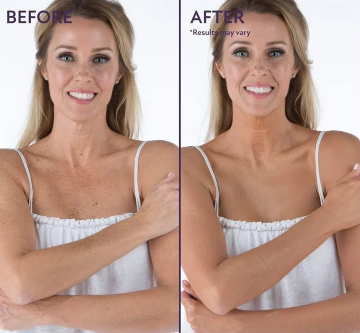 Anwendung von wasserfestem Body Make-up auf Frauenbein, für eine ebenmäßige Hautfarbe.