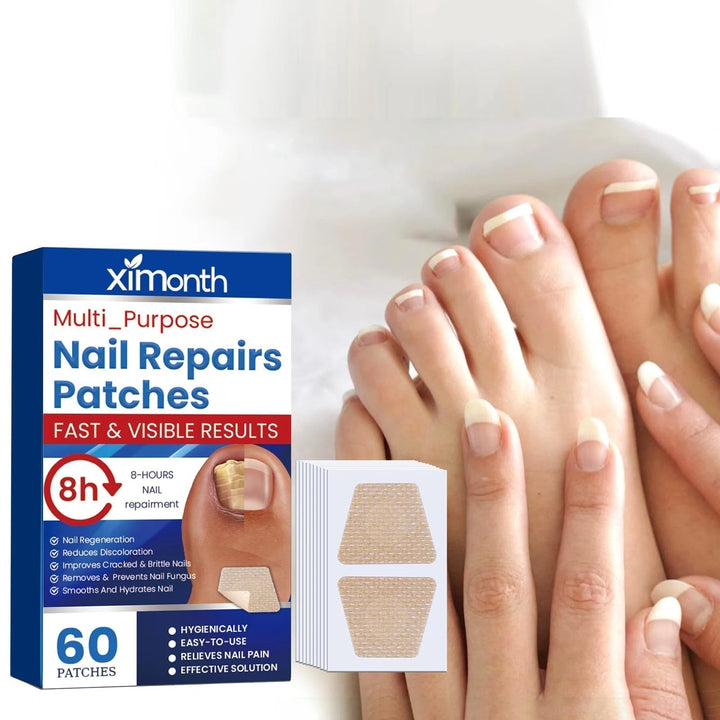 60er Set atmungsaktive Nagelpflege-Pflaster zur Behandlung von Fuß- & Fingernägeln.