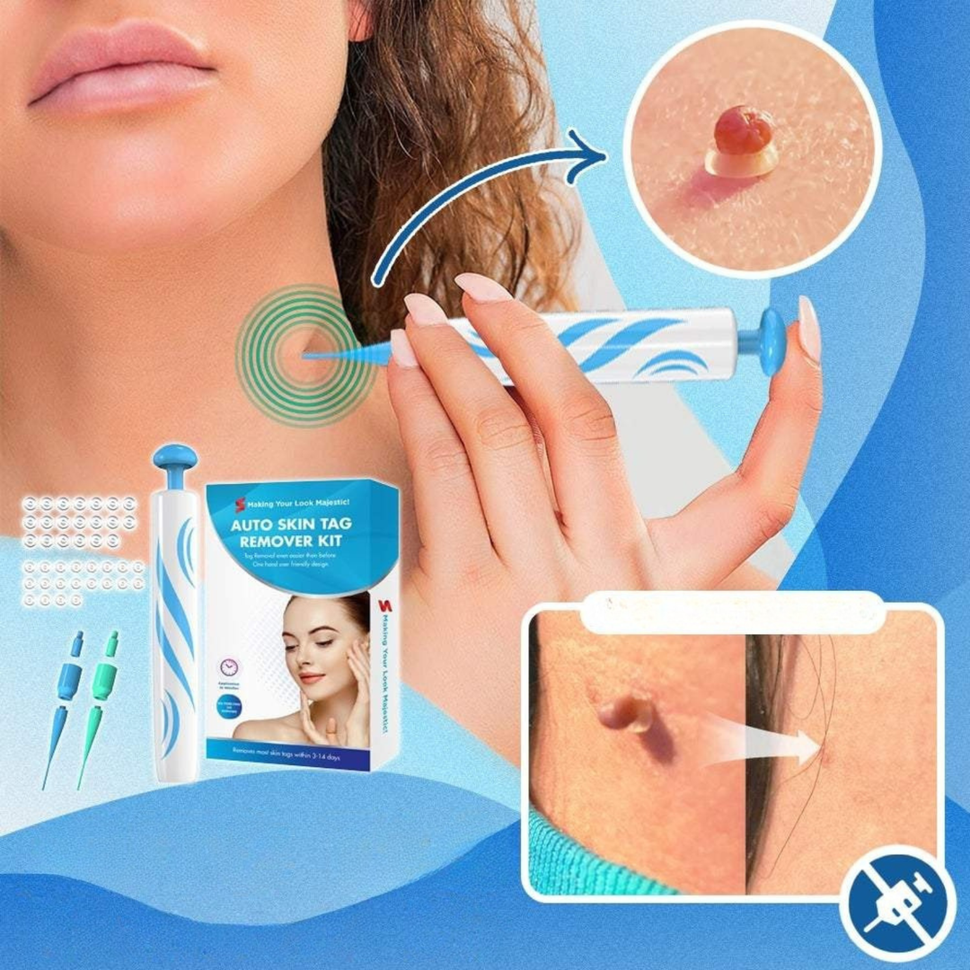 Detailansicht des Hautanhängsel Entferner Sets: Präzise Abbindeschlaufen für sichere und effektive Anwendung.