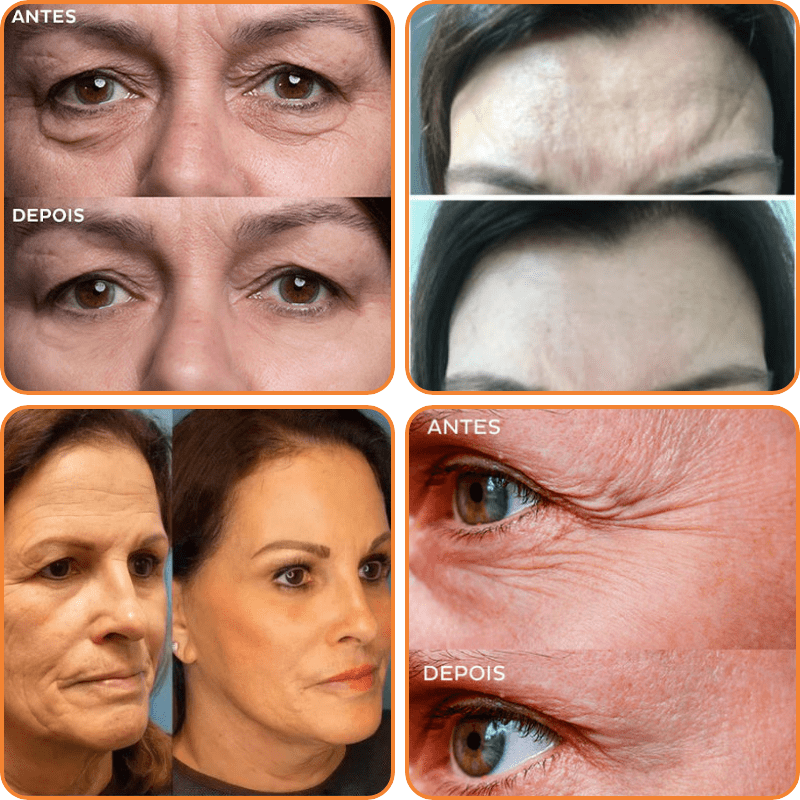 Anti-Falten Gesichtsmaske mit Kollagen & Hyaluronsäure. Reduziert Linien und sorgt für jugendlichen Teint.