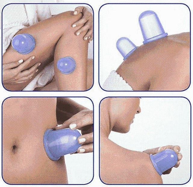 Entspannender Vakuum-Silikonbecher für Wellness zu Hause. Reduziert Cellulite, strafft & glättet die Haut.