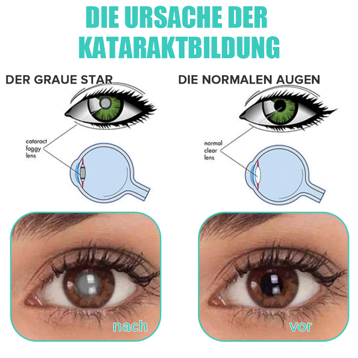 Mehrere Flaschen befeuchtender Augentropfen, Vorrat für klare Sicht & täglichen Augenschutz.