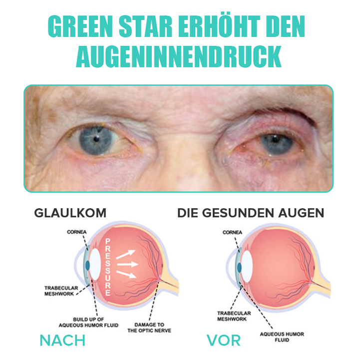 Verpackung befeuchtender Augentropfen: Flasche & Karton, für gesunde Augen & langanhaltende Frische.