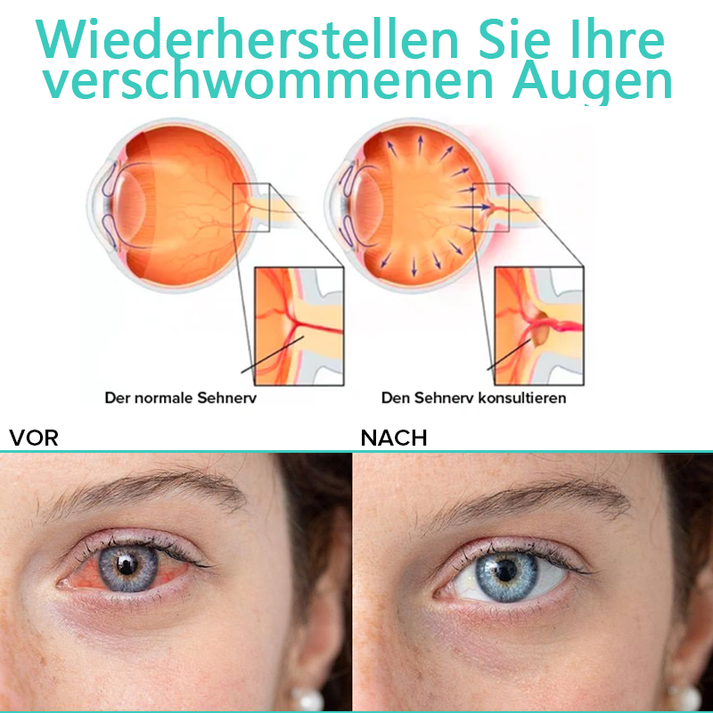 Sanfte Augentropfen für befeuchtende Augenpflege, beruhigen gereizte Augen & sorgen für Wohlbefinden.