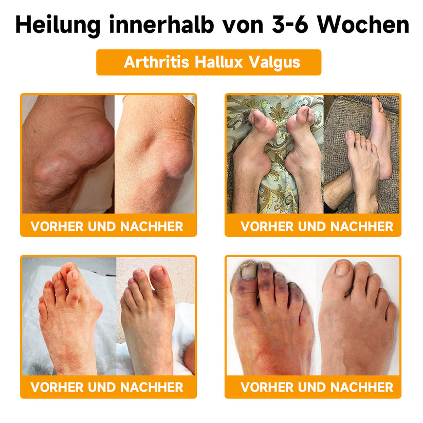 Nahaufnahme der cremigen Bienengiftcreme mit Hyaluron & Kollagen. Intensive Feuchtigkeitspflege für glatte Haut.
