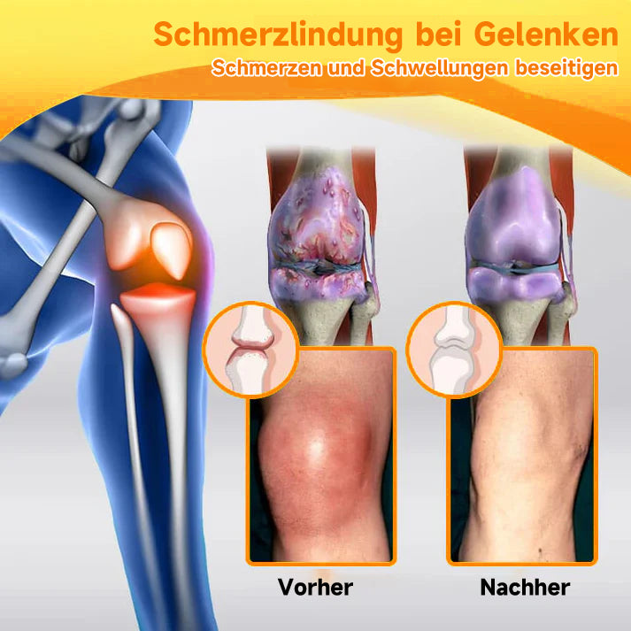 Bienengiftcreme mit Hyaluron & Kollagen zur Faltenreduzierung & Hautstraffung. Umfangreiche Gesichtspflege.