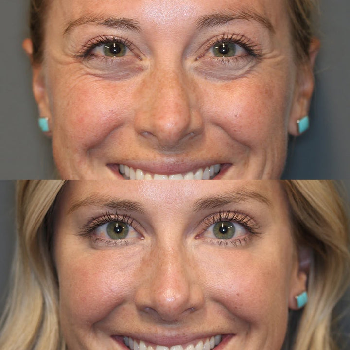 Anti-Aging Retinol Augenpflegestift für Frauen, reduziert Falten & strafft die Augenpartie. Mit Squalane.