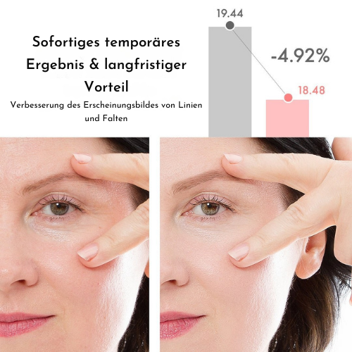 Retinol Augencreme Stick mit Squalane & Astaxanthin, spendet Feuchtigkeit & mindert Augenringe. Für Damen.