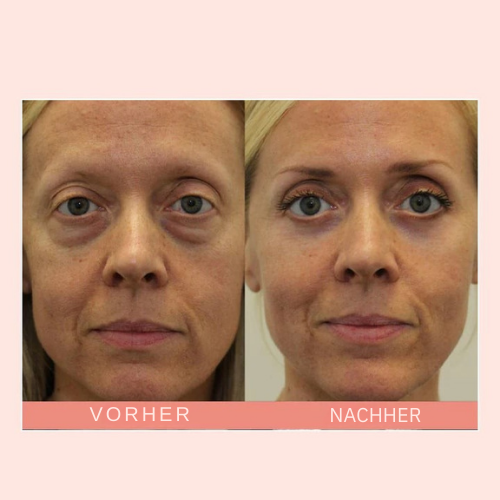 Retinol Augencreme Stick für Frauen, hellt dunkle Augenringe auf & belebt die empfindliche Haut. Anti-Aging.