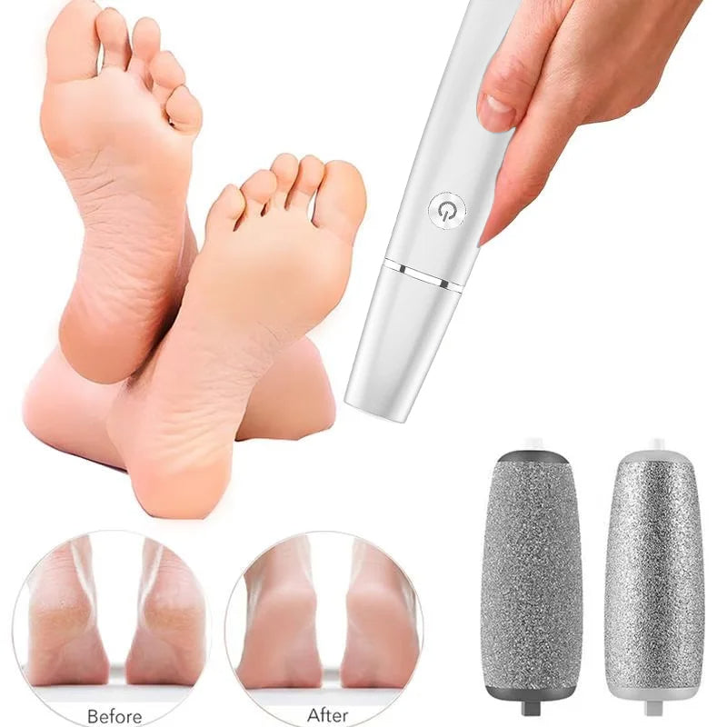 Handlicher elektrischer Hornhautentferner für einfaches Fußpeeling und professionelle Fußpflege.