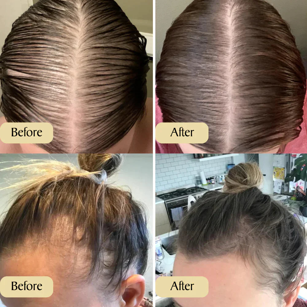 Rosmarin Haaröl & 11 Pflanzenöle. Silikon- & parabenfrei für Haarwachstum, starke Haare & gesunde Kopfhaut.