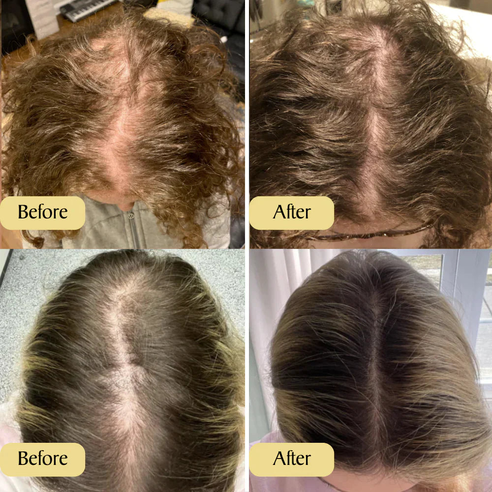 Glänzendes, starkes Haar dank Rosmarin Haarwuchsöl mit 11 Pflanzenölen. Vegane Naturkosmetik für Haarpflege.