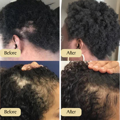 Anwendung von Rosmarin Haaröl auf die Kopfhaut. Fördert Haarwachstum & stärkt das Haar mit Pflanzenölen.