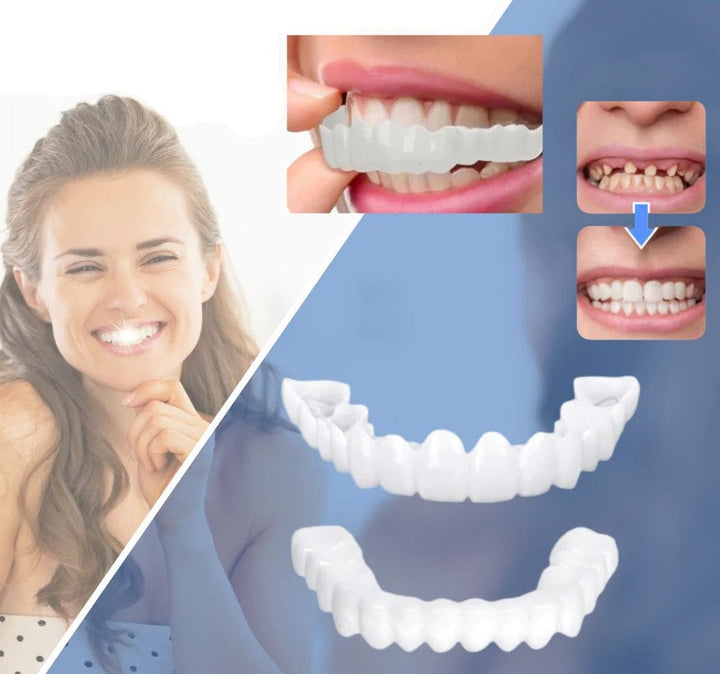 Flexible kosmetische Veneers für Erwachsene, verbessern das Lächeln sofort und sorgen für strahlend weiße Zähne.