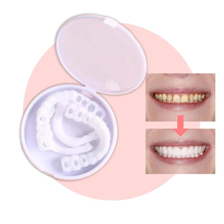 Komfortable flexible Veneers für den Alltag, ideal für ein selbstbewusstes und schönes kosmetisches Lächeln ohne Kleber.