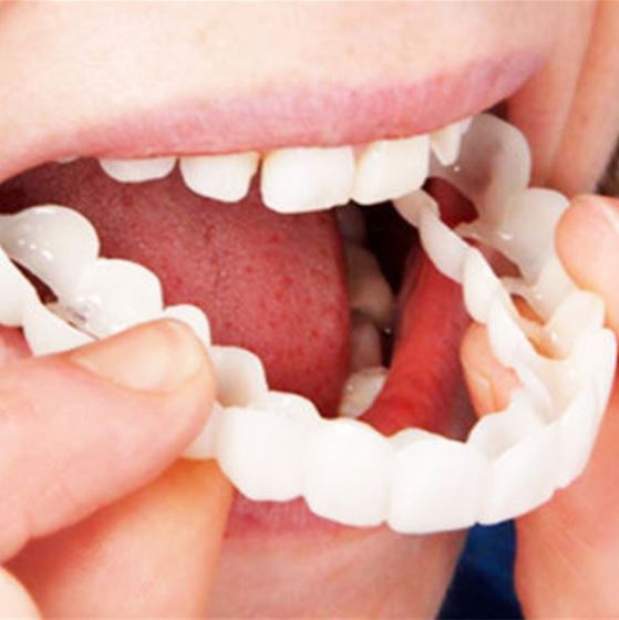 Person mit strahlendem Lächeln, dank flexibler kosmetischer Veneers für Zähne, verbesserte Zahnästhetik schnell.