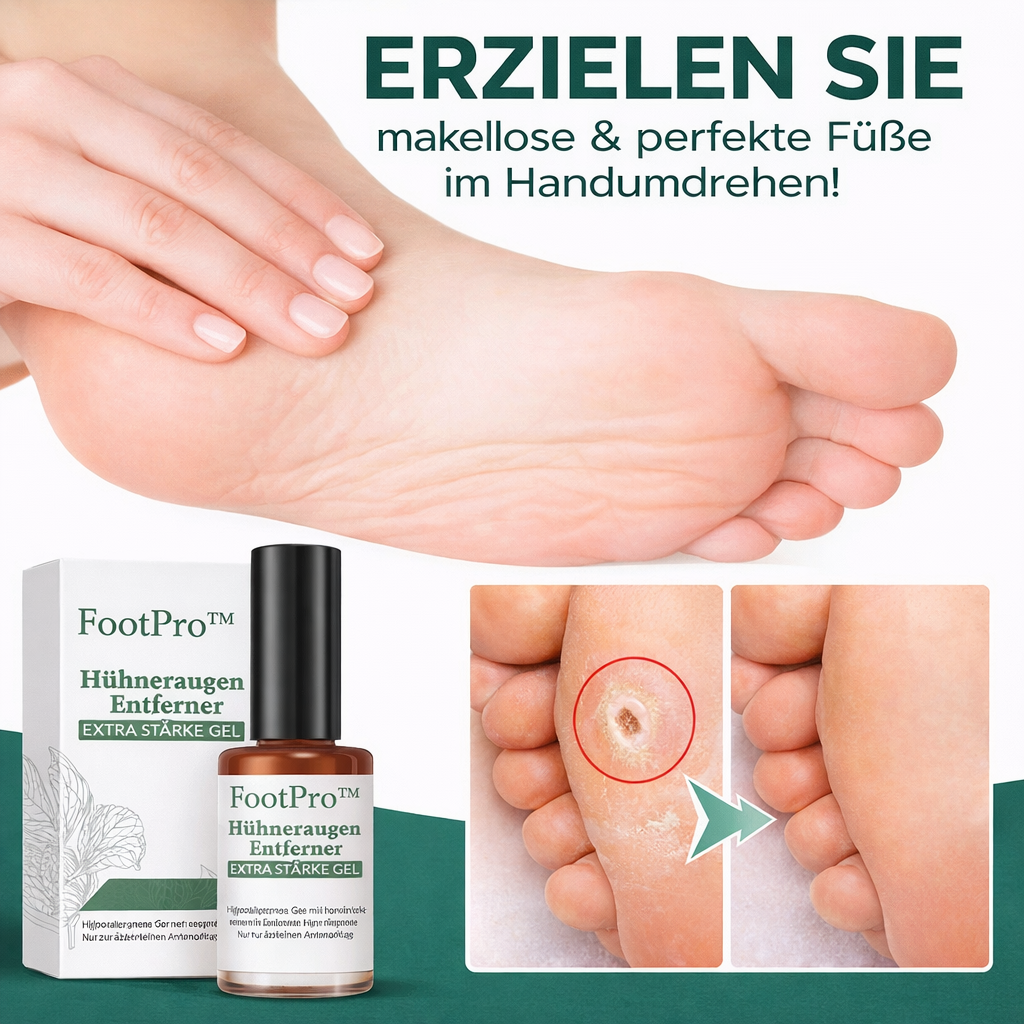 Hornhautentferner Gel für schmerzfreie Fußpflege, entfernt Schwielen & Hühneraugen effektiv für glatte Füße.