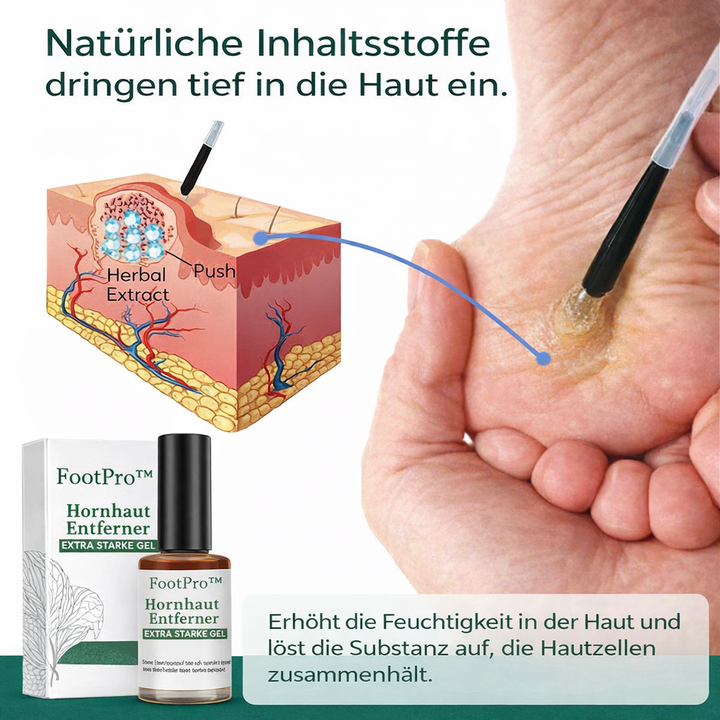Glatte, gepflegte Füße nach Anwendung des Hornhautentferner Gels. Effektive Hautpflege gegen Hornhaut & Schwielen.