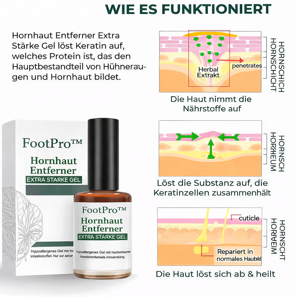 Hornhautentferner Gel Flasche. Spezialpflege zur schmerzfreien Entfernung von Hornhaut, Hühneraugen & Schwielen.