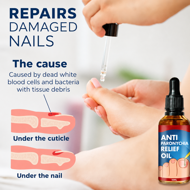 Eine Hand trägt Nagelreparatur-Serum auf brüchige Nägel auf. Fördert Nagelstärkung & gesunde Fingernägel.