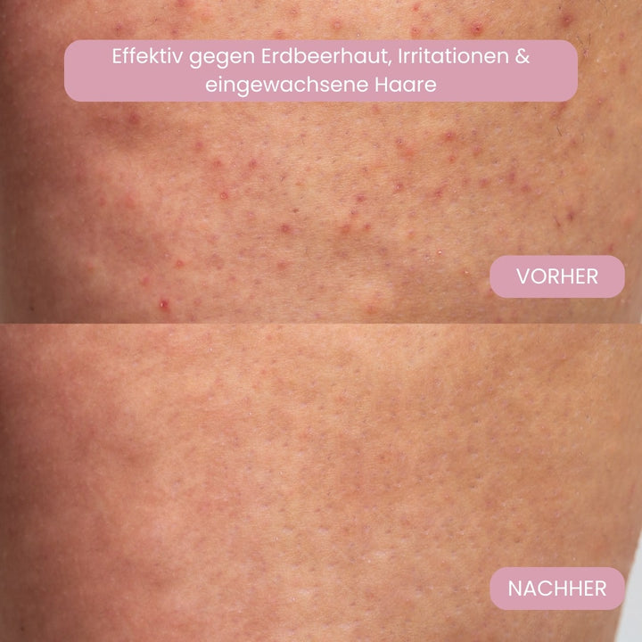 Bikini Trimmer für Frauen, sanfte Haarentfernung mit präziser Klinge für glatte Ergebnisse.