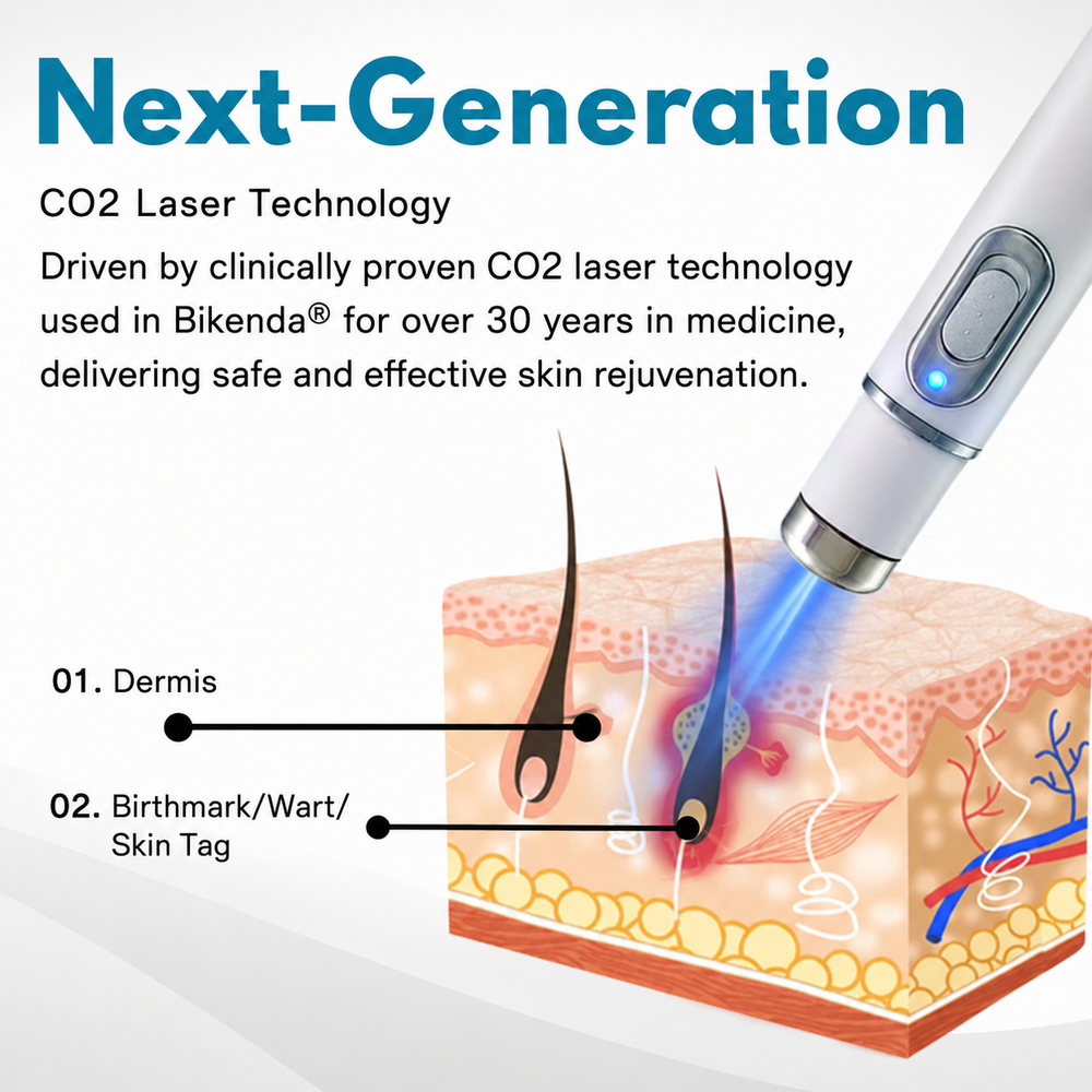 Detailansicht der präzisen Spitze des CO₂-Lasers für gezielte Warzen- & Muttermalentfernung.