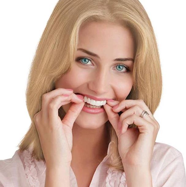 Kosmetische Snap-On Veneers für ein sofortiges, strahlendes Lächeln mit natürlich aussehenden, weißen Zähnen.