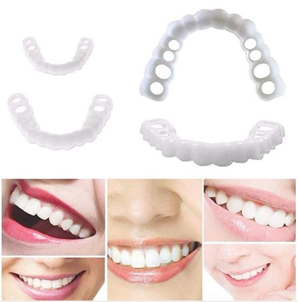 Ästhetische Snap-On Veneers für schnelle Zahnkorrektur, bieten ein makelloses, natürlich weißes Lächeln.