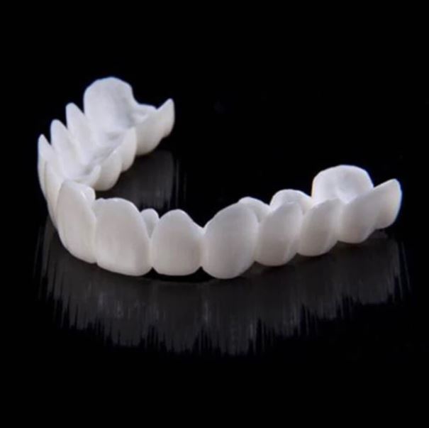Kosmetische Snap-On Veneers, die Ihre Zahn-Optik sofort verbessern und Ihnen ein strahlendes Lächeln geben.