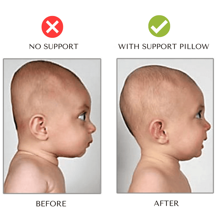 Stützkissen für Babys, entlastet Druck und stützt Kopf & Nacken von 0-15 Monaten im Kinderwagen.