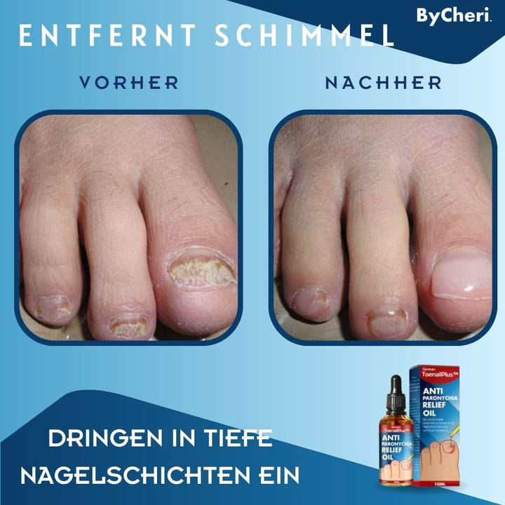 Flasche Nagelpflege Tropfen, ein Nagelöl zur Stärkung & Reparatur von brüchigen Fingernägeln und Zehennägeln.