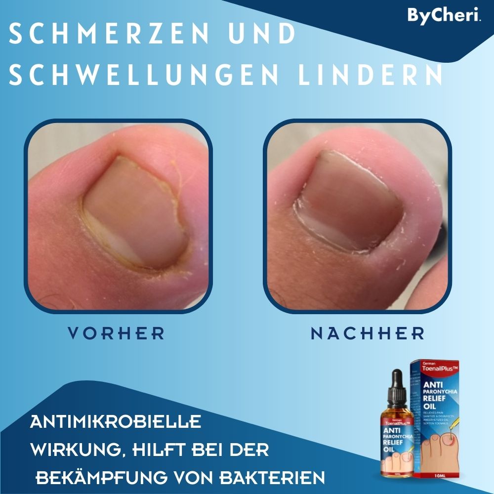 Regenerierende Nagelpflege Tropfen für gesunde, starke Nägel; ideal bei brüchigen Fingernägeln & Zehennägeln.