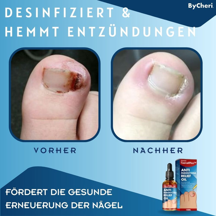 Intensive Nagelpflege Tropfen für Fingernägel & Fusspflege; stärkt Nägel, fördert gesunde Nägel & Regeneration.