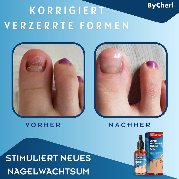 Nahaufnahme der Nagelpflege Tropfen: klares Nagelöl für intensive Nagelregeneration & Stärkung brüchiger Nägel.