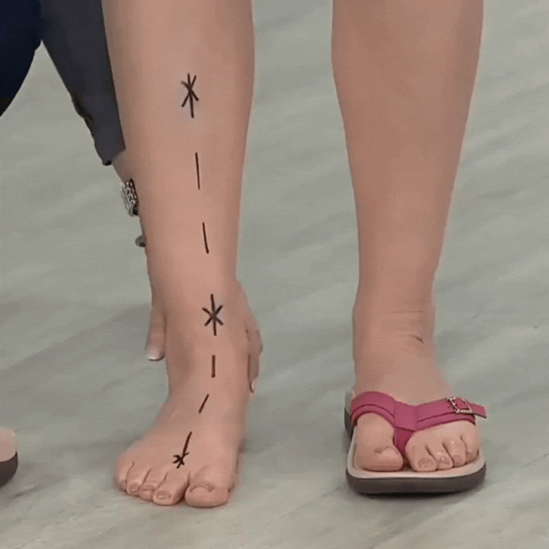 Orthopädische Damen Sandalen mit Fußgewölbestütze & Dämpfung. Ideal bei Fersenschmerzen und Plattfüßen für Komfort.