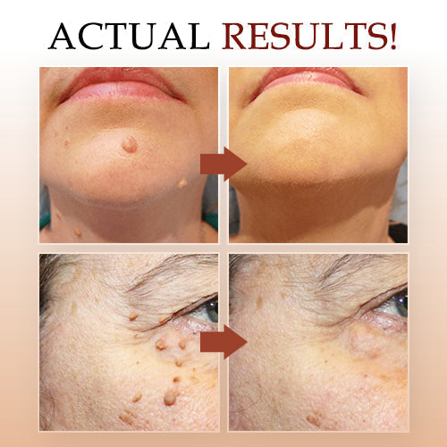 Dieses pflanzliche Serum verfeinert das Hautbild und sorgt für glatte, ebenmäßige Haut. Perfekte Damen-Gesichtspflege.