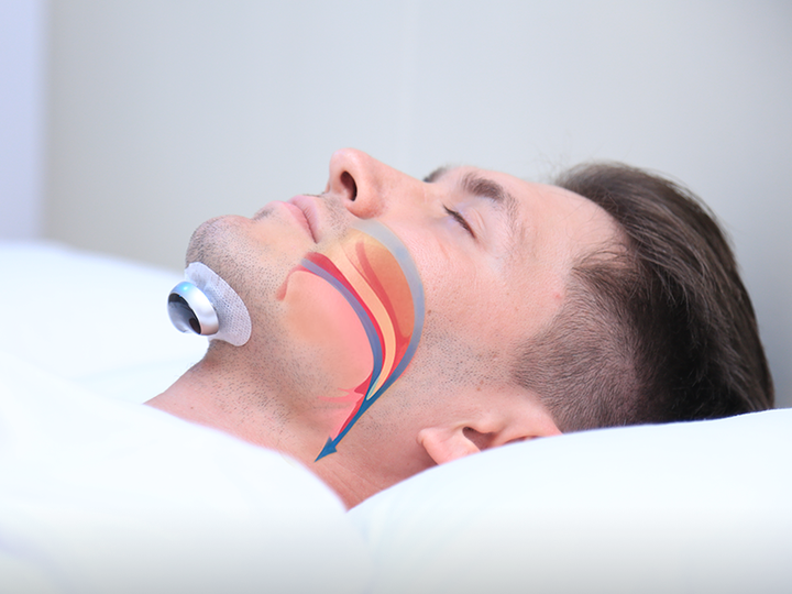 Detailansicht des QuietWave Anti-Schnarch-Geräts, ein komfortabler Schnarchstopper für jede Nacht.