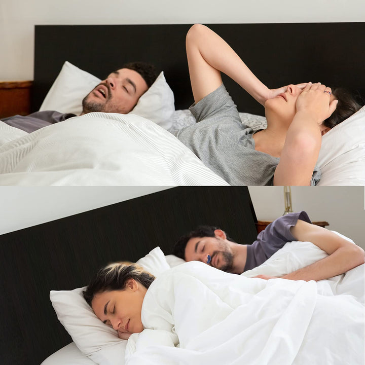 Innovatives Anti-Schnarch-Gerät: maskenloser, schlauchloser Mikro-CPAP löst Schlafapnoe diskret.