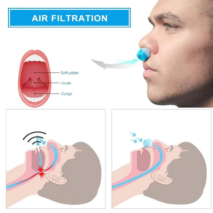 Für Ihre Wellness: tragbares Anti-Schnarch-Gerät, Mikro-CPAP mit Nasendilatator für freies Atmen.