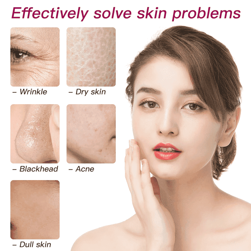 Praktischer Gesichtsdampfer: Tiefenreinigung der Poren, Aknebehandlung & verbesserte Hautstruktur für Beauty.