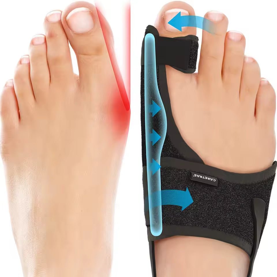 Effektive Hallux Valgus Nachtschiene zur Korrektur & Linderung von Fußschmerzen, komfortabel & unisex.