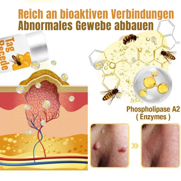 Warzenentferner Spray mit Bienengift zur schnellen Hautpflege. Ideal gegen Hautunreinheiten und Warzen.